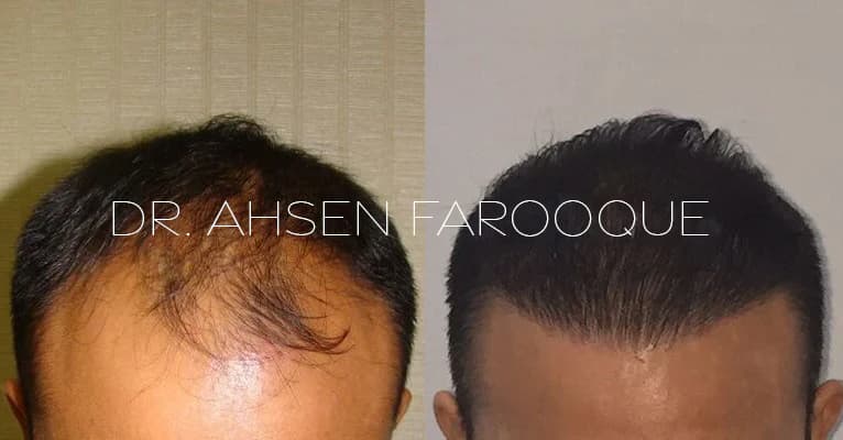 before-after-0